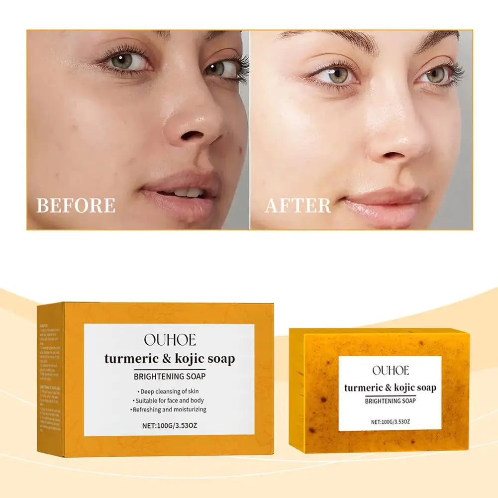 100g Turmeric Soap, Lemon Kojic Acid Soap, Shower And Facial Soap Body Care  Face Cleanser Turmeric  Soap Body and Face Cleaning