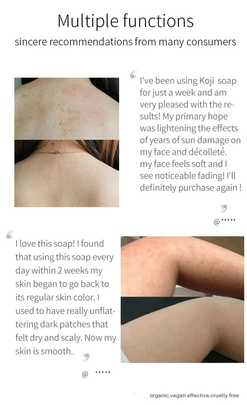 Kojic Acid Body Whitening Soap Deep Skin Bleaching Brighten Body Scrub Knees Intimate Parts Armpits White Nourishing Care Soap