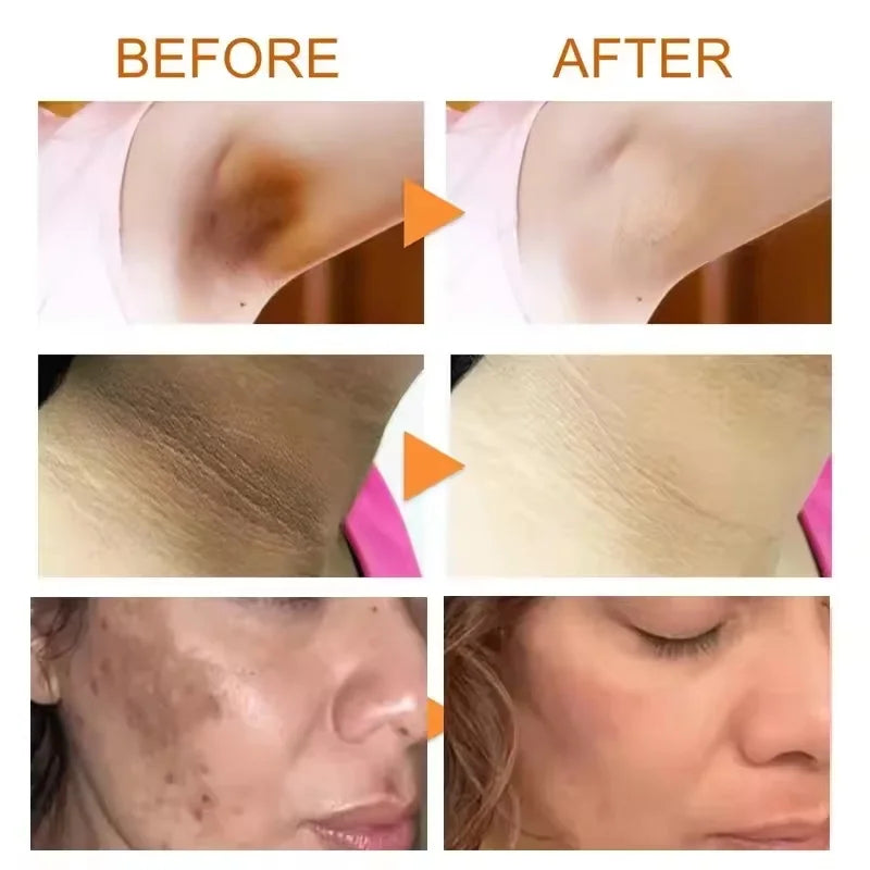 Kojic Acid Body Whitening Soap Deep Skin Bleaching Brighten Body Scrub Knees Intimate Parts Armpits White Nourishing Care Soap