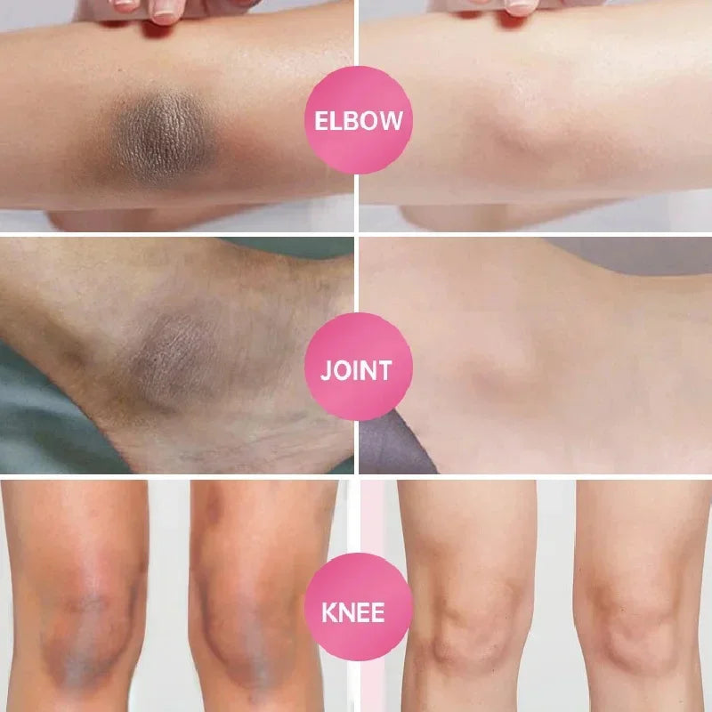 Kojic Acid Body Whitening Soap Deep Skin Bleaching Brighten Body Scrub Knees Intimate Parts Armpits White Nourishing Care Soap