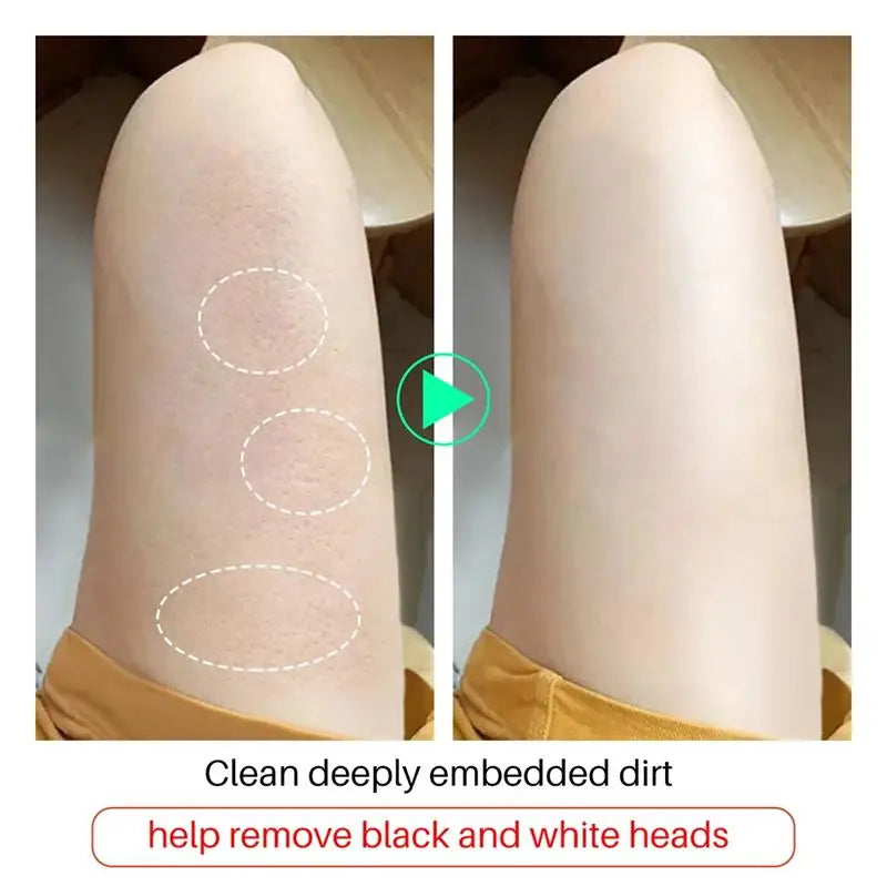 Kojic Acid Body Whitening Soap Deep Skin Bleaching Brighten Body Scrub Knees Intimate Parts Armpits White Nourishing Care Soap