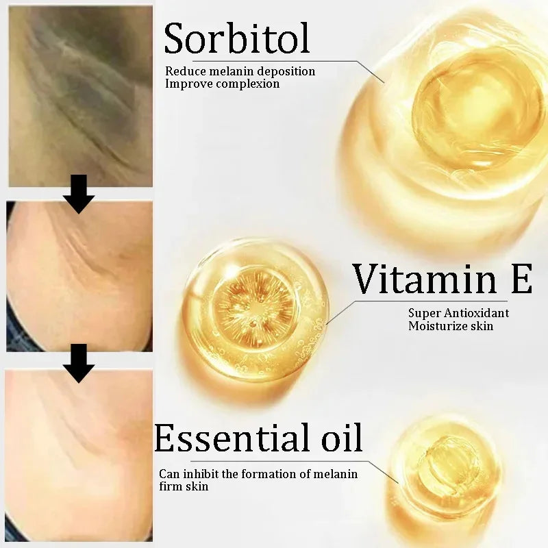 Kojic Acid Body Whitening Soap Deep Skin Bleaching Brighten Body Scrub Knees Intimate Parts Armpits White Nourishing Care Soap